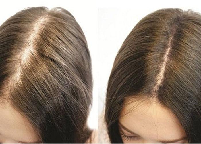 Как использовать масло усьмы для роста волос