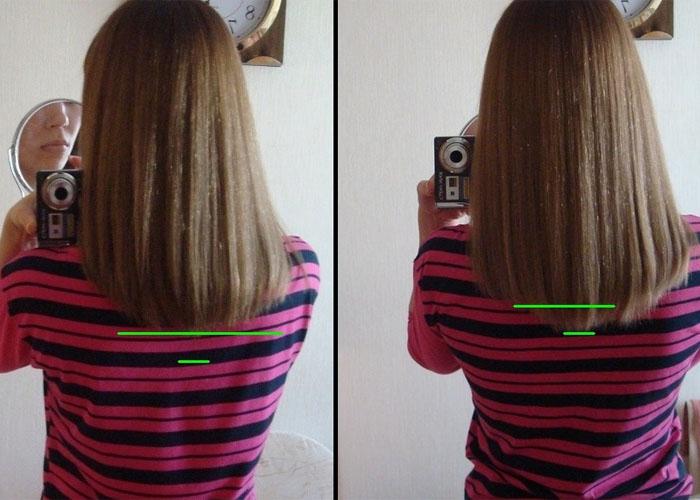 Процедура для роста волос током