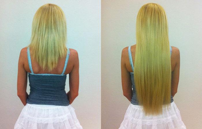 Эксидерм активатор роста волос до и после фото