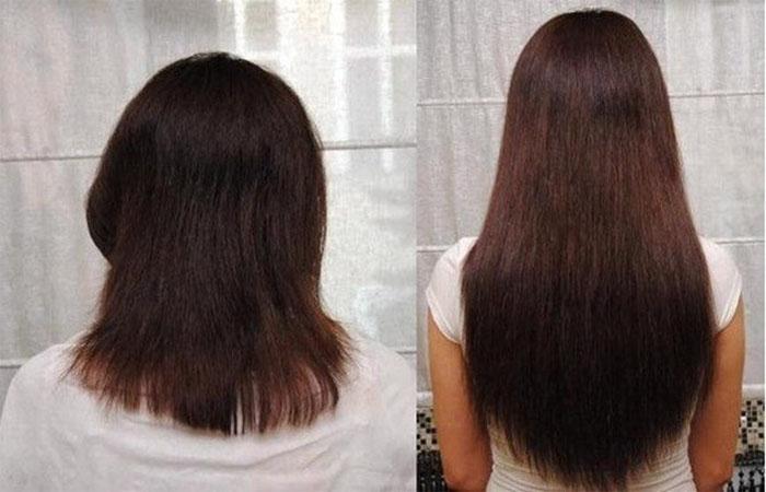 Эксидерм активатор роста волос до и после фото thumbnail