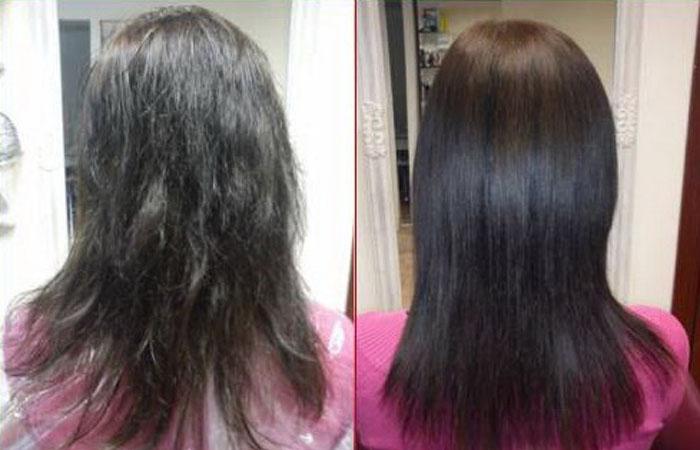 Ампулы для волос от выпадения диксон