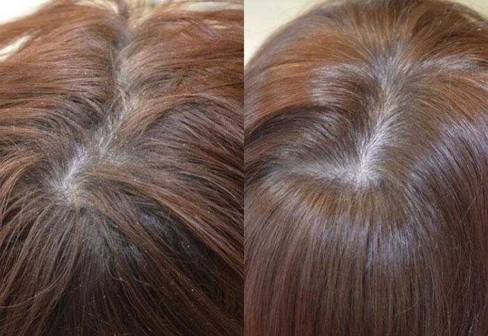 Чемеричная вода для роста волос фото до и после