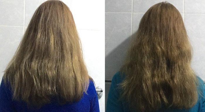 Состав для роста волос с димексидом