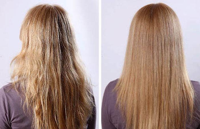 Рост волос от витаминов мерц