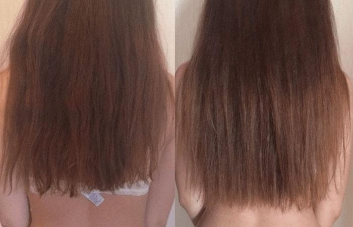 Витамины пантовигар для волос фото до и после