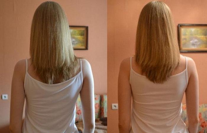 Витамины пантовигар для волос фото до и после