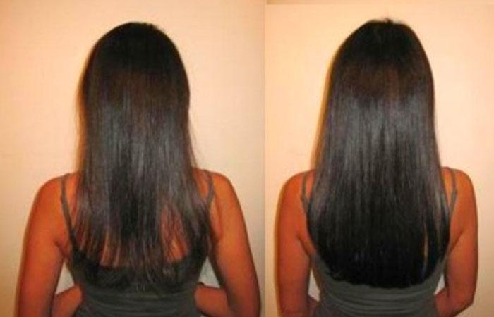 Усилитель роста волос от nioxin