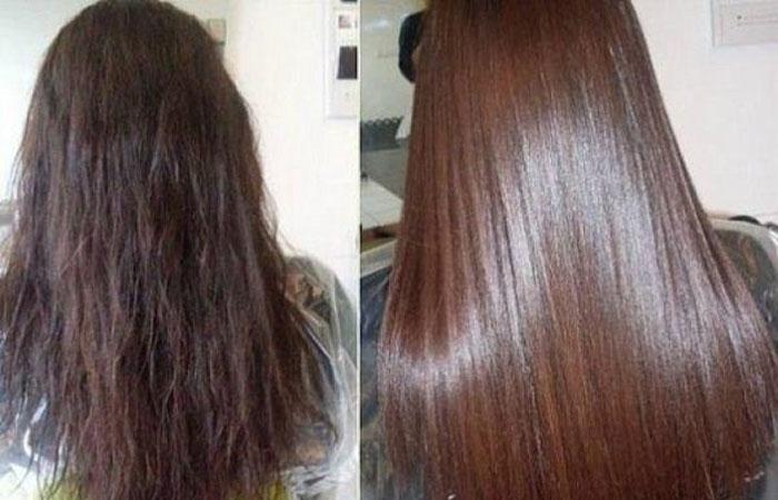 Алерана помогает для роста волос