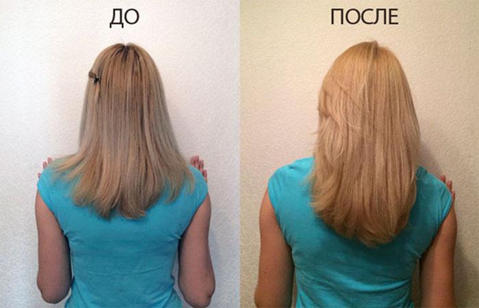 Экстракт алоэ в ампулах для роста волос
