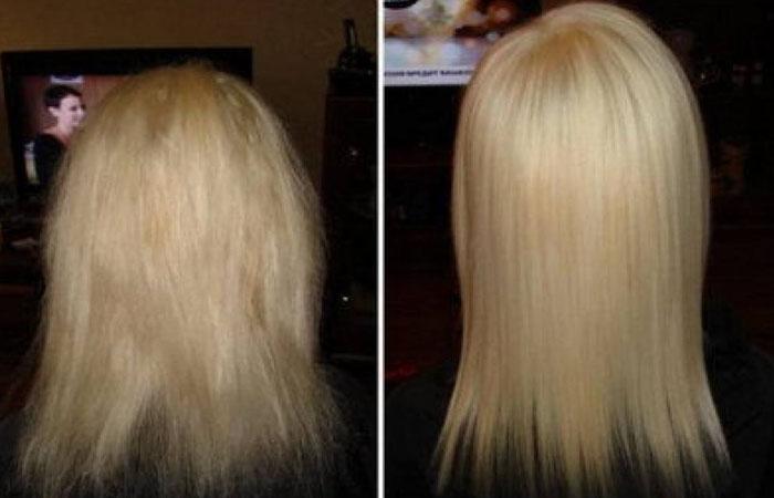 Влияет ли имбирь на рост волос