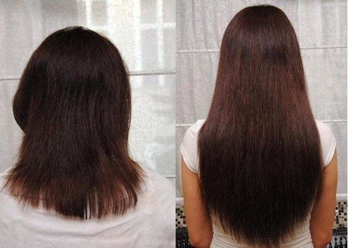 Дегтярное мыло помогает росту волос