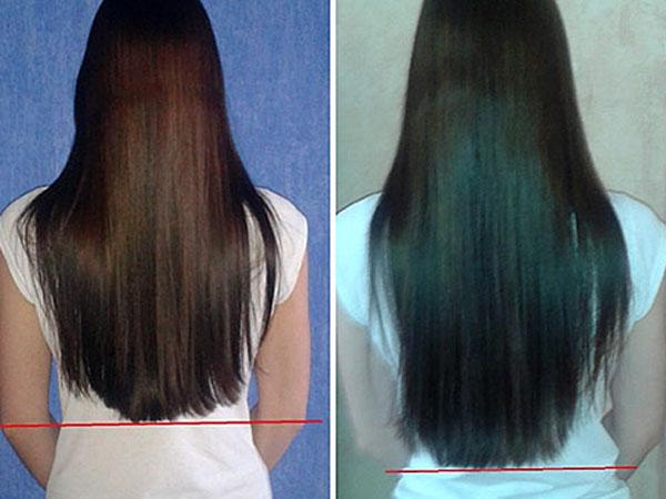 Алерана шампунь для роста волос фото до и после