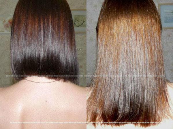 Дегтярный шампунь помогает росту волос