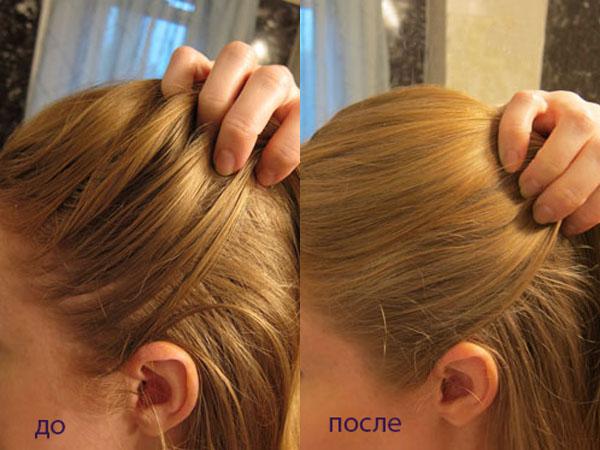 Шампунь алерана против выпадения волос для жирных и комбинированных волос
