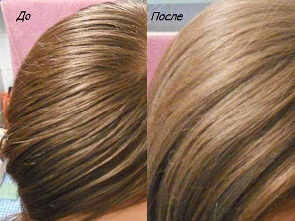 Шампунь алерана против выпадения волос для жирных и комбинированных волос