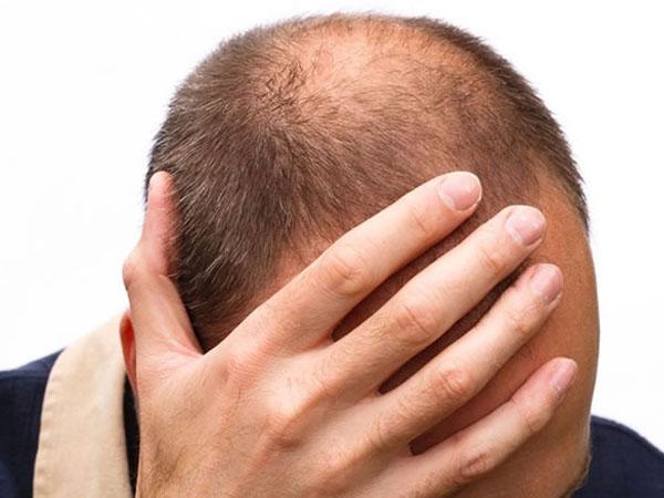 Какие витамины пить против выпадения волос для мужчин