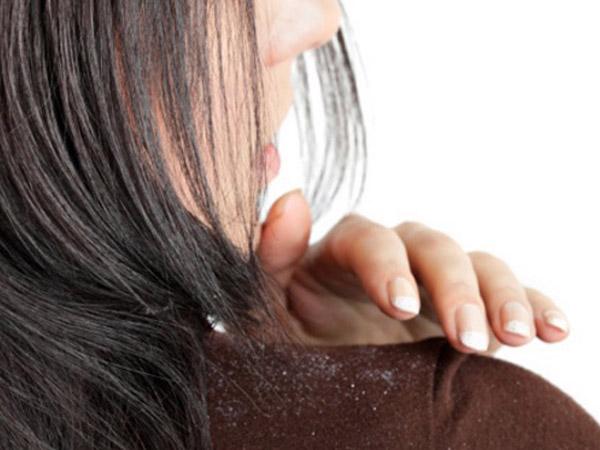Зуд и шелушение волосистой кожи головы
