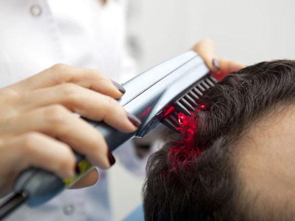 Аппаратное лечение волос при выпадении
