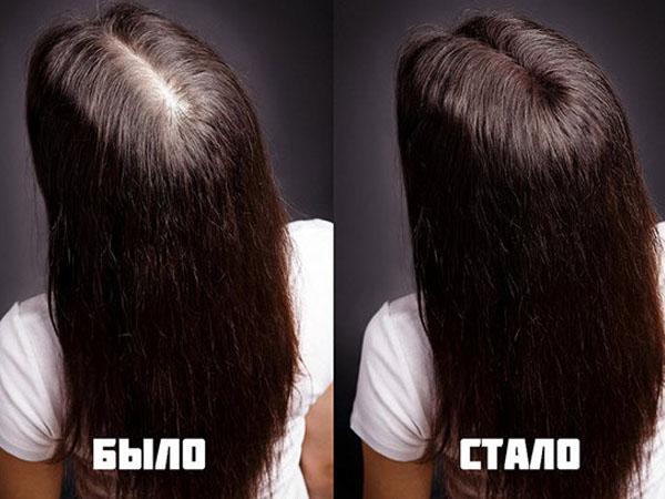 Лазерная терапия для волос противопоказания