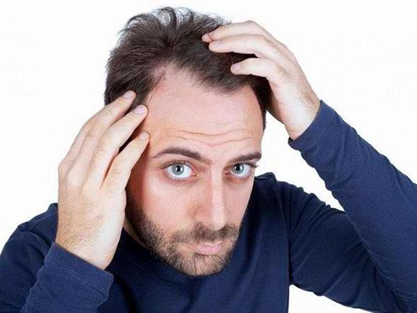 Эффективные шампуни от выпадения волос у мужчин