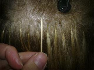 Наращивание волос у мужчин на лысину