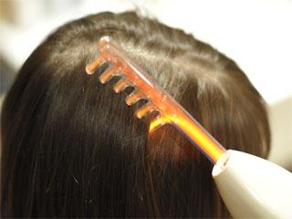 Как влияет на рост волос дарсонваль