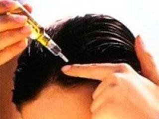 Витамин для роста волос на голове в ампулах