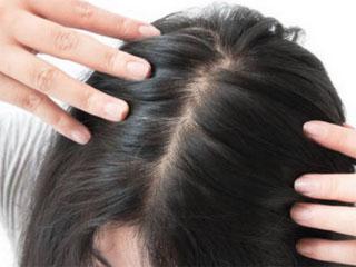 Перхоть зуд выпадение волос лечение в домашних условиях