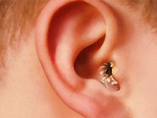 Как вылечить чешуйки в ушах
