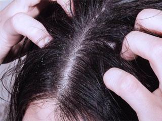 Активатор роста волос средство против перхоти