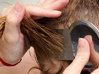 Как отмыть волосы от гнид