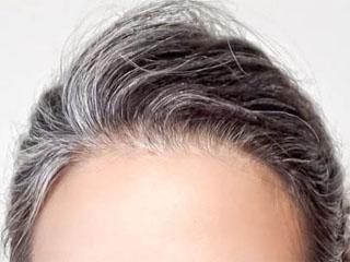 Причина седых волос в раннем возрасте у мужчин