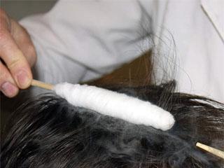 Криомассаж волосистой части головы показания и противопоказания