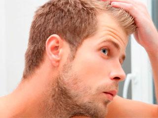 Андрогенетическое выпадение волос у мужчин