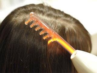 Выпадение волос у детей очаговой алопеции