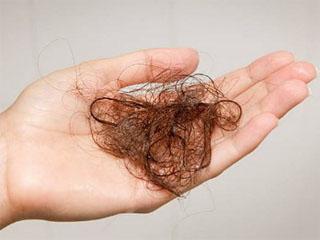 Норма выпадения волос: как узнать, сколько волос выпадает в день и что делать, если норма превышена?