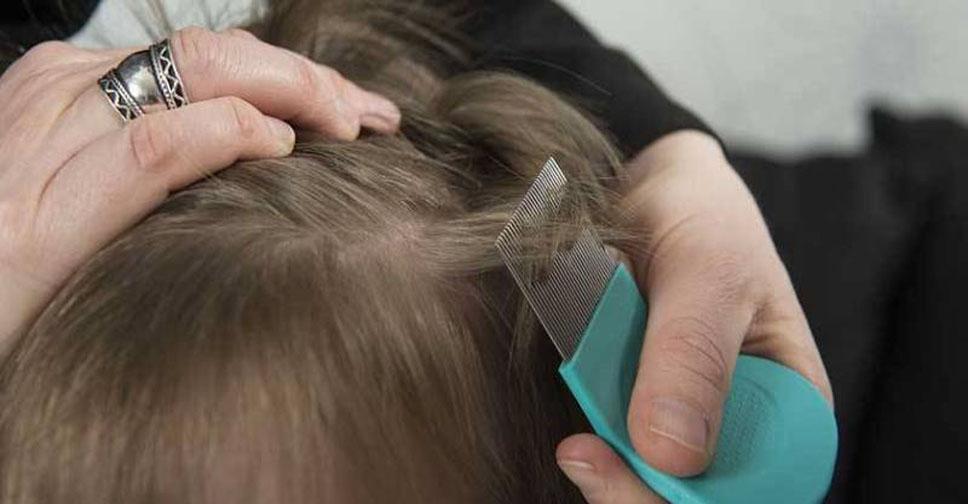 Откуда берутся вши: от чего появляются, как передаются, от чего ...