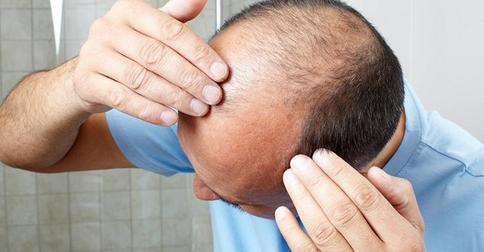 Английские ученые нашли очередное средство уменьшающее выпадение волос
