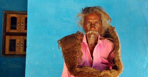 Житель Индии 40 лет не мыл и не расчесывал волосы